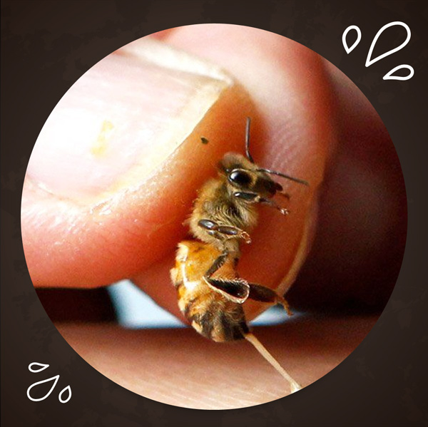 Apitherapy / Bee Venom Therapy